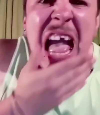 Congratulations, you’ve won a no expenses paid trip to the dentist! (Xpost r/GIFtedIndividuals)