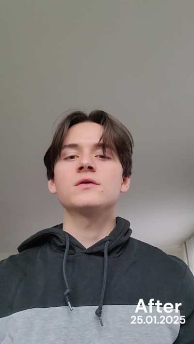 Singing the same song 1 year apart (progress after 1 year of vocal lessons)