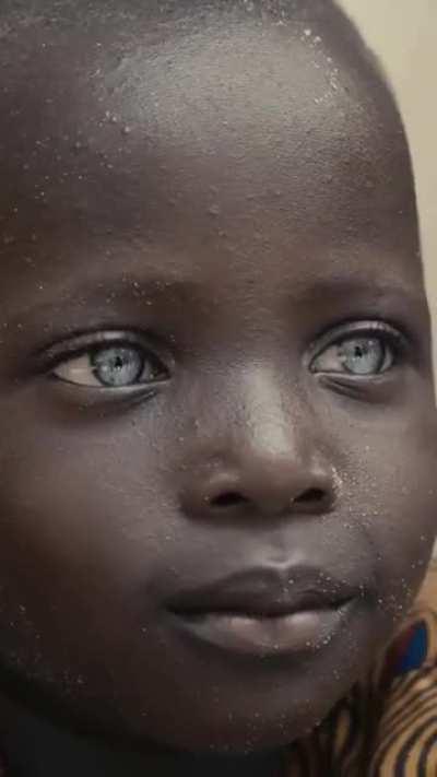 Beautiful Blue Eyes Are Amazing 🥹