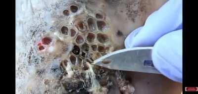 Трипофобы и лица со слабым желудком - проходите дальше.