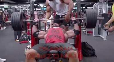 Pec tear during bench press.