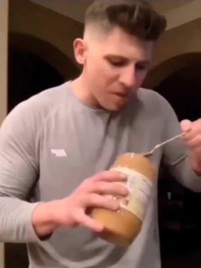 What a bad allergic reaction looks like