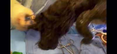 Heard y’all like trichobezoar videos.