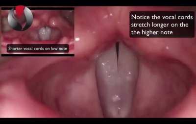 What vocal chords look like when singing