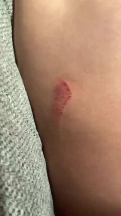 My own meat crayon from riding a bike