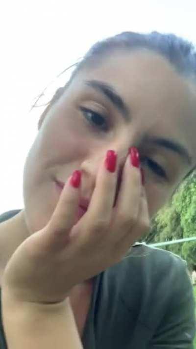 Freckles in the park