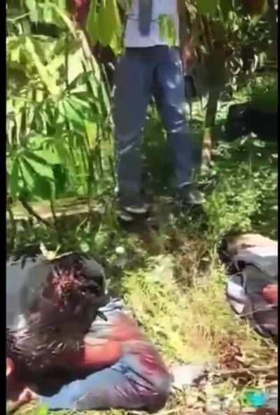 Guy in agony after having face peeled off in accident