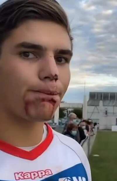 Thanks, I hate cut water.