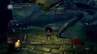 Cause of death: Knees