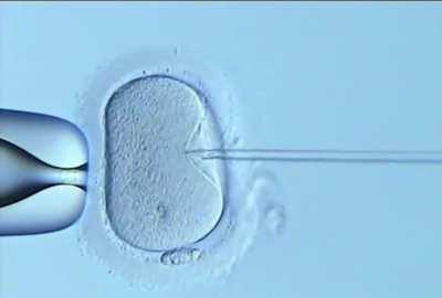 Sperm being inserted directly into the egg in laboratory …