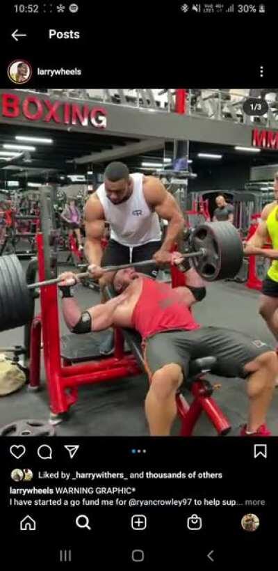 Ryan Crowley's torn pec looks absolutely horrendous