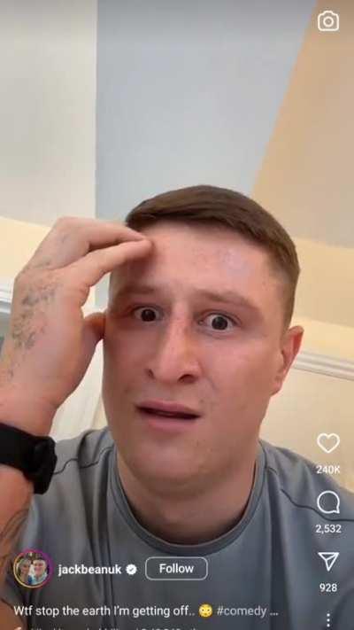 ✨ASMR✨ chewing on implants 