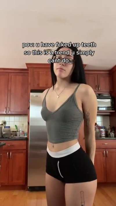 Bad teeth but good everything else