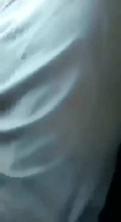 sick man gets treated😨😨😨💔