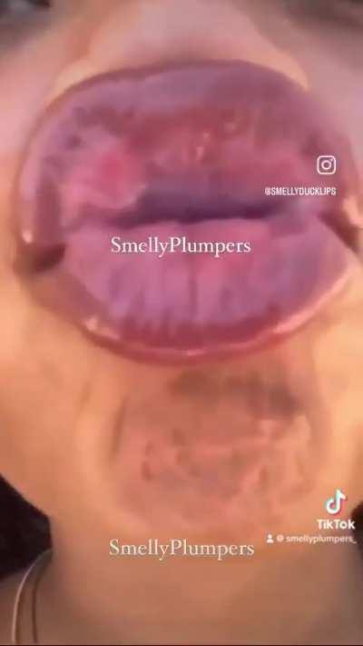 Nutty Stankers 💁‍♀️