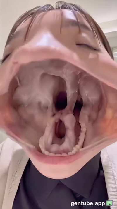 Is this what the dentist means by open wide?