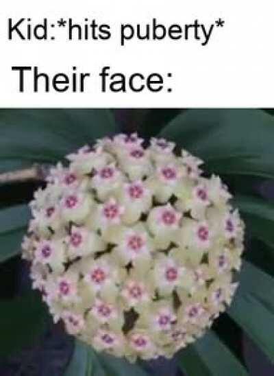 Haha pimples go popop