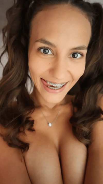 Am I hot with braces? F28