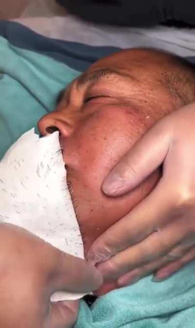 Dude got his face waxed