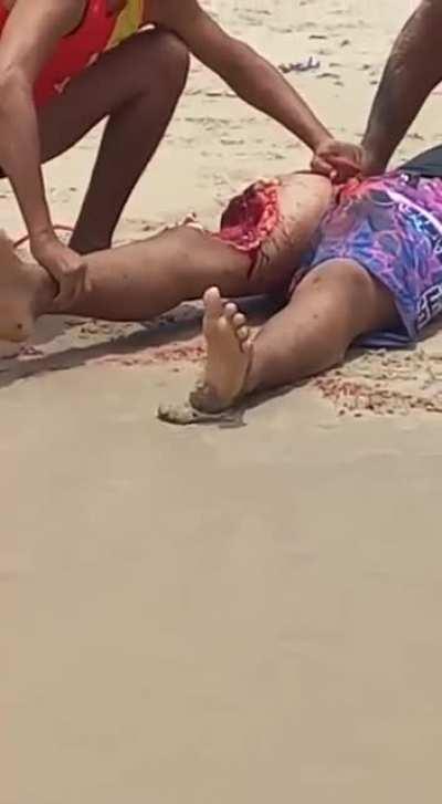 Shark attack in Recife, Brasil.