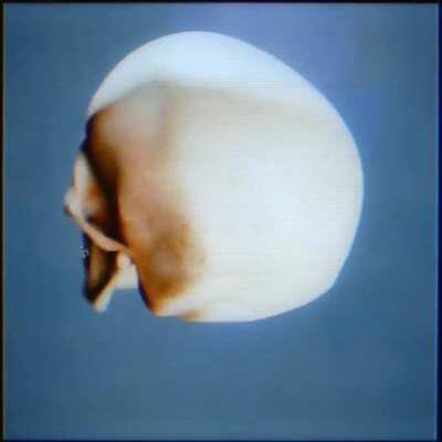 Make sure my teeth gold when I'm filled up with formaldehyde