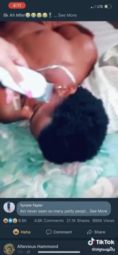 Man woke up and it was on sight lmfao