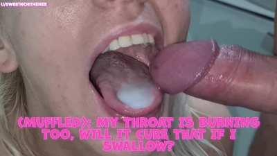 Would you try this new burn cream? 🤣😋