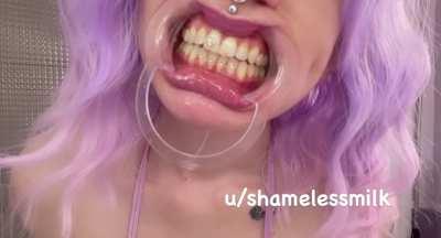 Drooling from my Dental Gape