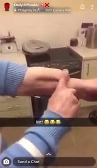 He's growing a new penis on his arm