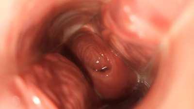 Showing my open cervix again