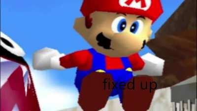 why are his teeth like this?