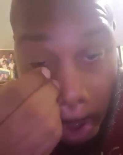 The habanero treatment for baggy eyes.