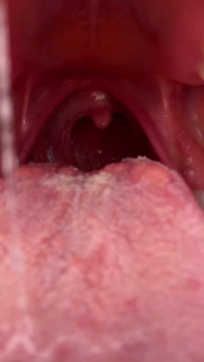 Your going to take an acid bath….🛁😈