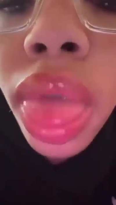 i love a pretty brace face 😩