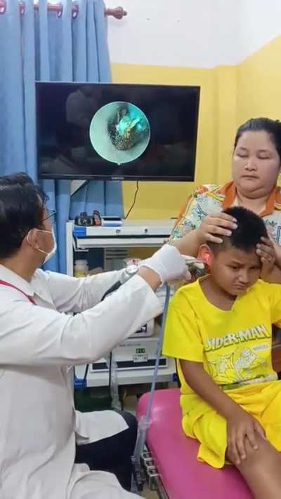 This is how doctors get things out of people's ears