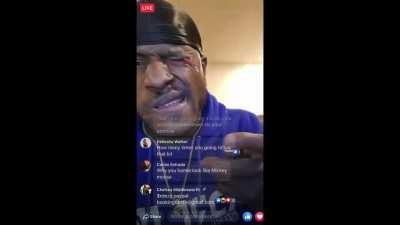 So thats how he got his eyepatch