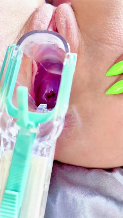 My first time using a speculum and now I am obsessed :)