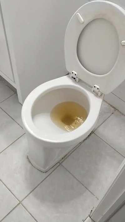 Super told me he fixed the raw sewage leaking into my apartment. This was his solution.