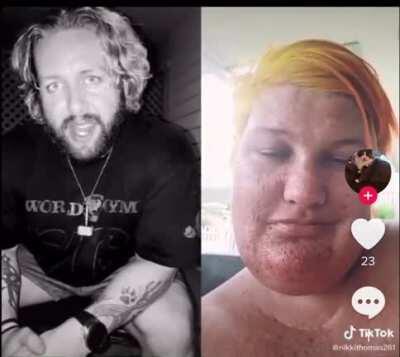 Trypophobia and a double dose in 1!