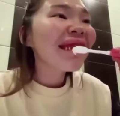 Dental care is important