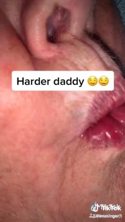 I think granny forgot the meds