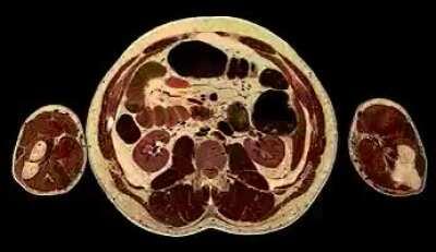 MRI head to toe of human body
