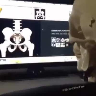 BONEr