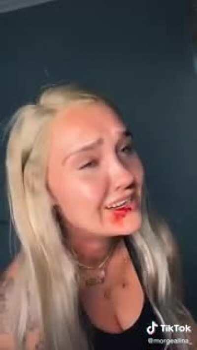 Will YOU take the vaccine?