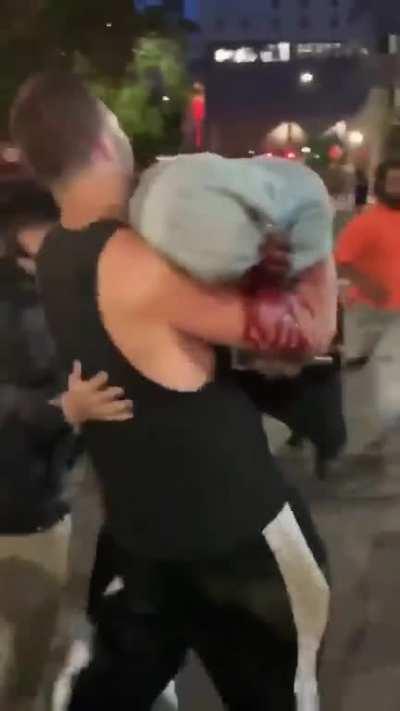 Black teenager shot in face by Sacramento police tonight