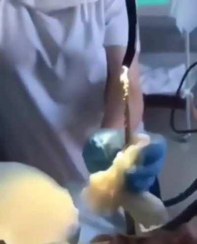 Medics pull 4ft snake from woman’s mouth after it slithered down there while she slept.
