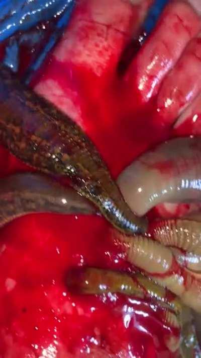 Baby giant Asian buffalo and European medicinal leech feeding time