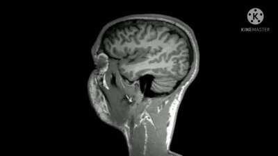 Şeker derken ilaçtan bahsettim. İllegal bir şey değil yani.