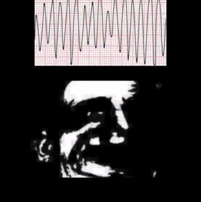 your rhythm is: damn irregular