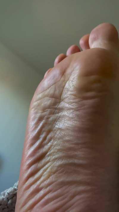 How many wrinkles can you count with your tongue?